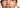 Unveiling the Truth Behind Skin Purging: What You Need to Know