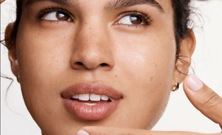 Unveiling the Truth Behind Skin Purging: What You Need to Know